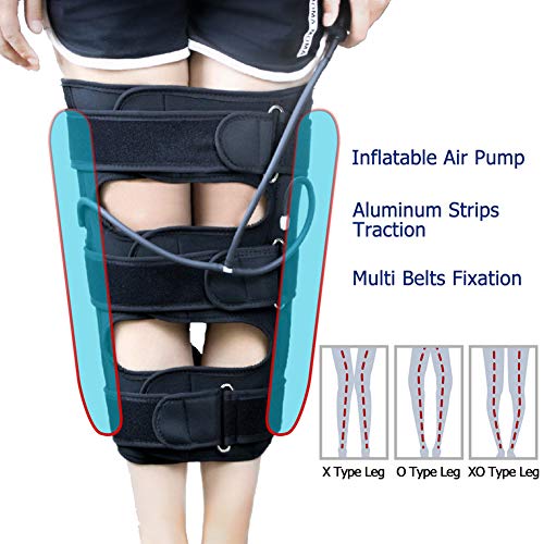 O/X Leg Type Correction Belt,Knock Knee Braces,Knock Knees Valgus Deformity Bow Legs Band,Legs Posture Corrector Belt,Straighten Belt for Children and Adult