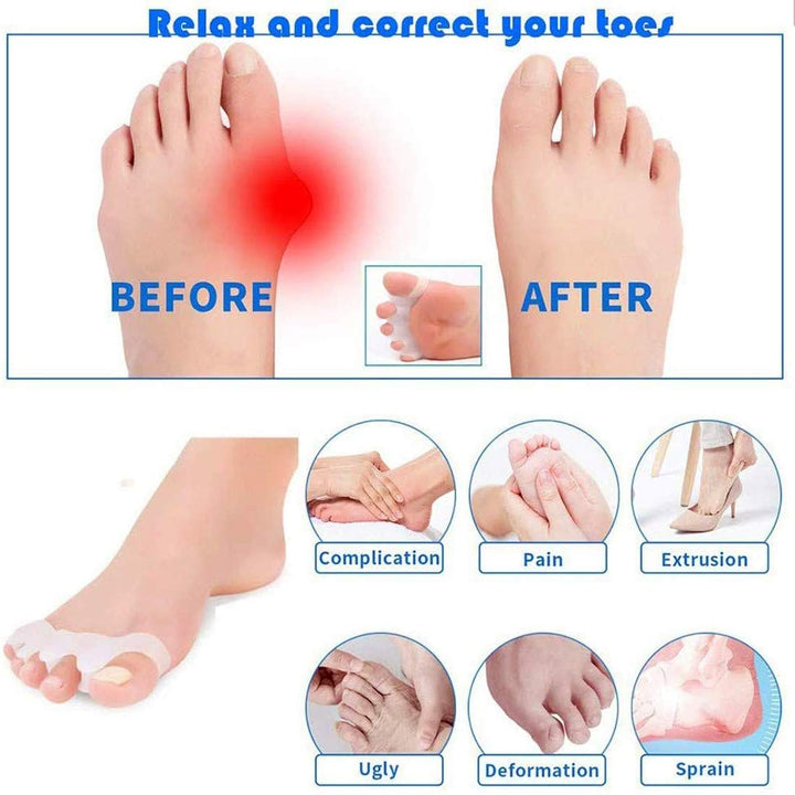 Gel Toe Separators, Silicone Toe Spacers for Foot Pain 