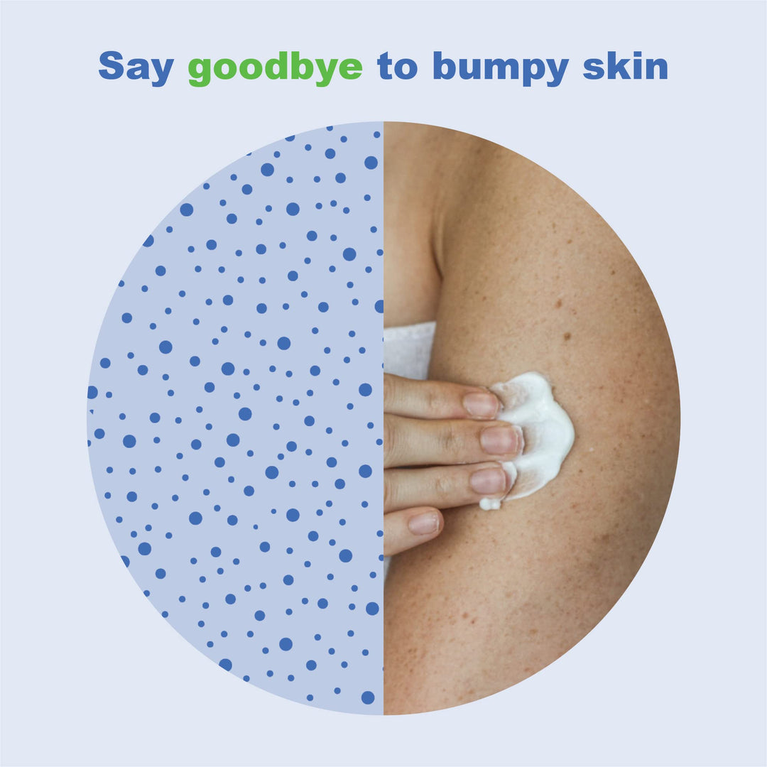 KP+Elements Keratosis Pilaris Cream