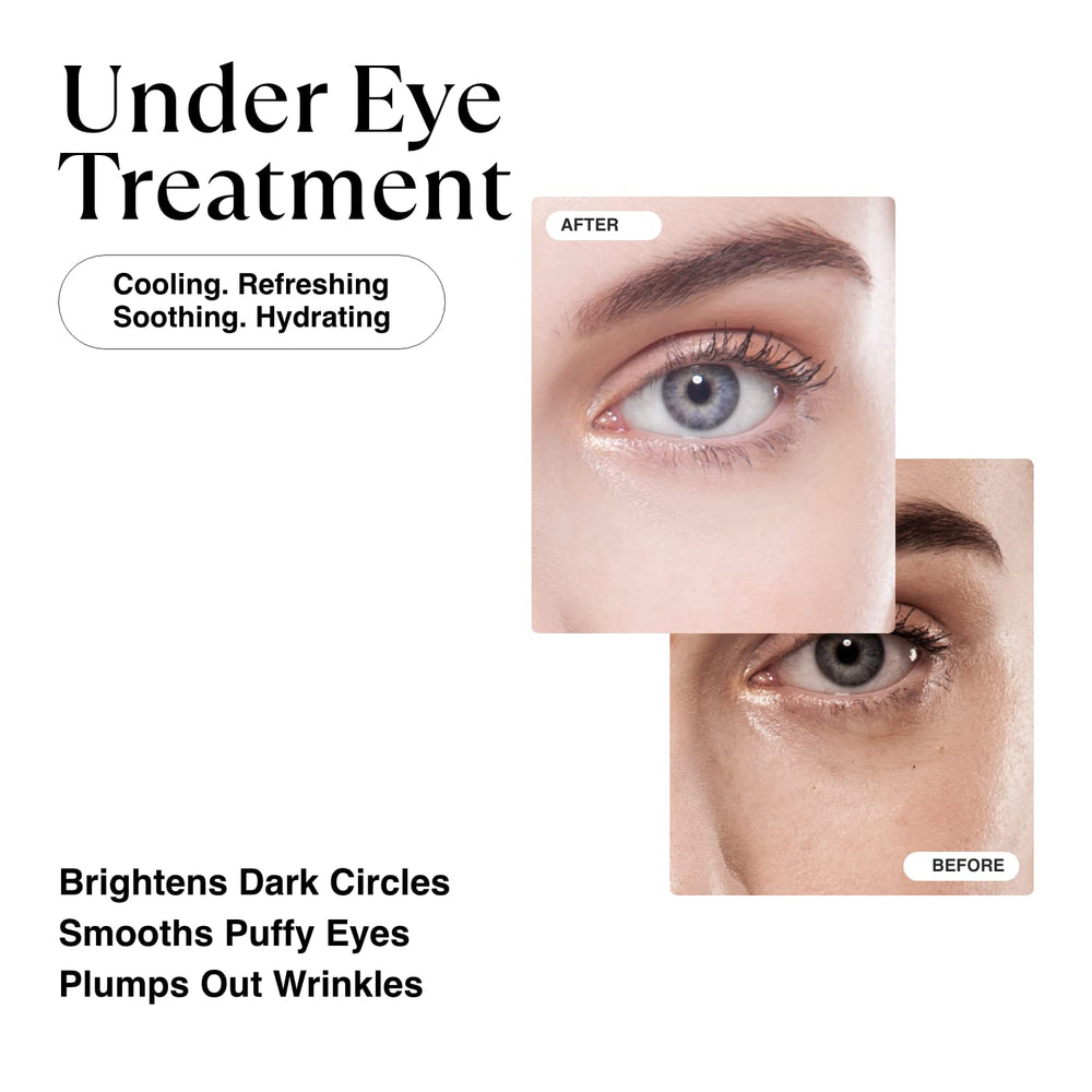 Korean Gold Under Eye Patches for Dark Circles and Puffiness, Wrinkles - Retinol + Hyaluronic Acid + Collagen + Niacinamide, Under Eye Mask Puffy Eyes Treatment for Women Skin Care