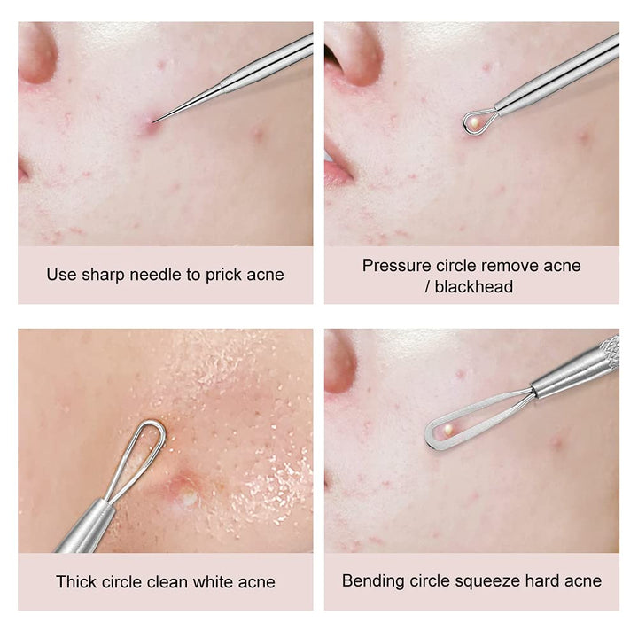 Black Head Remover, Rounded