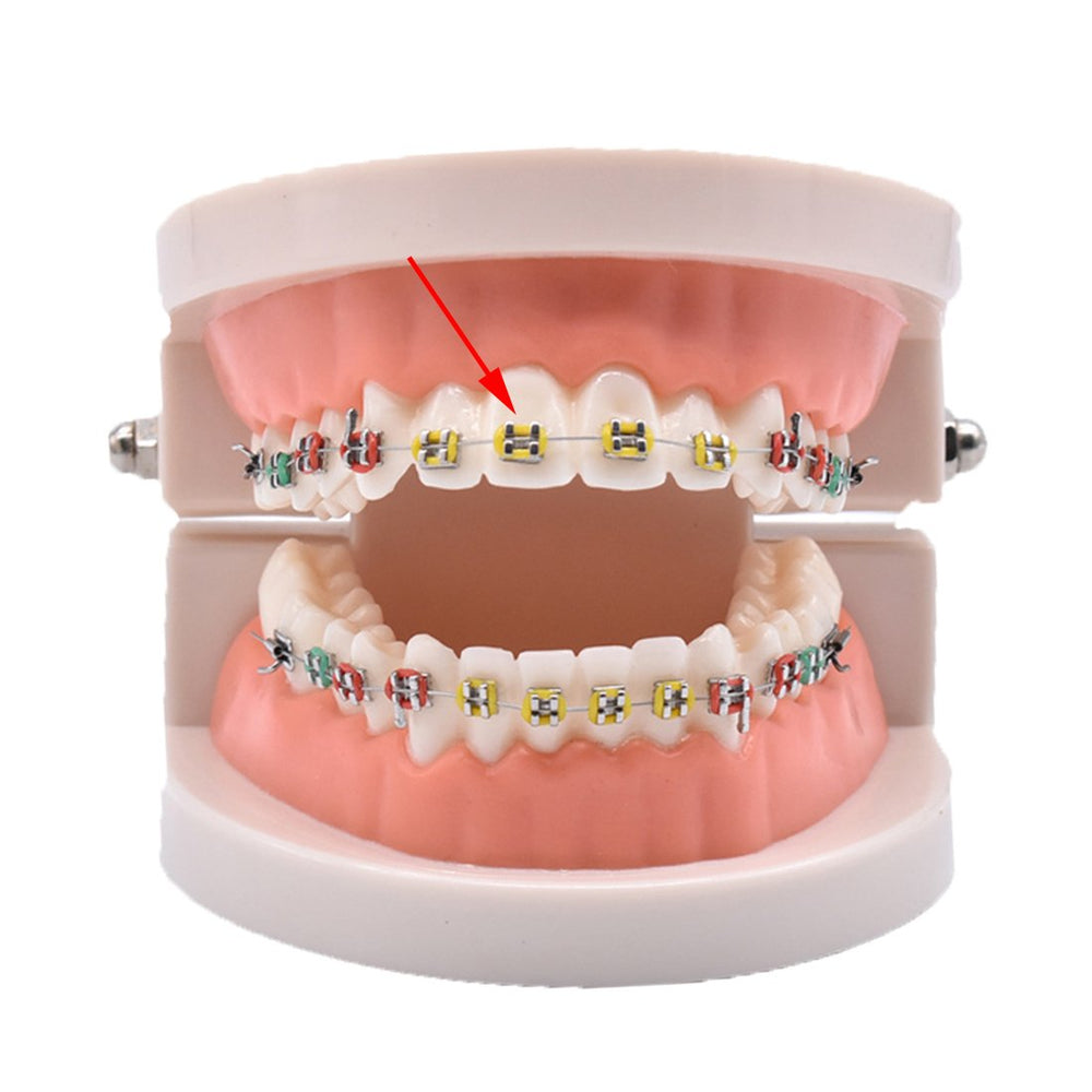 Wecando Orthodontic Ligature Ties Multi-color Orthodont