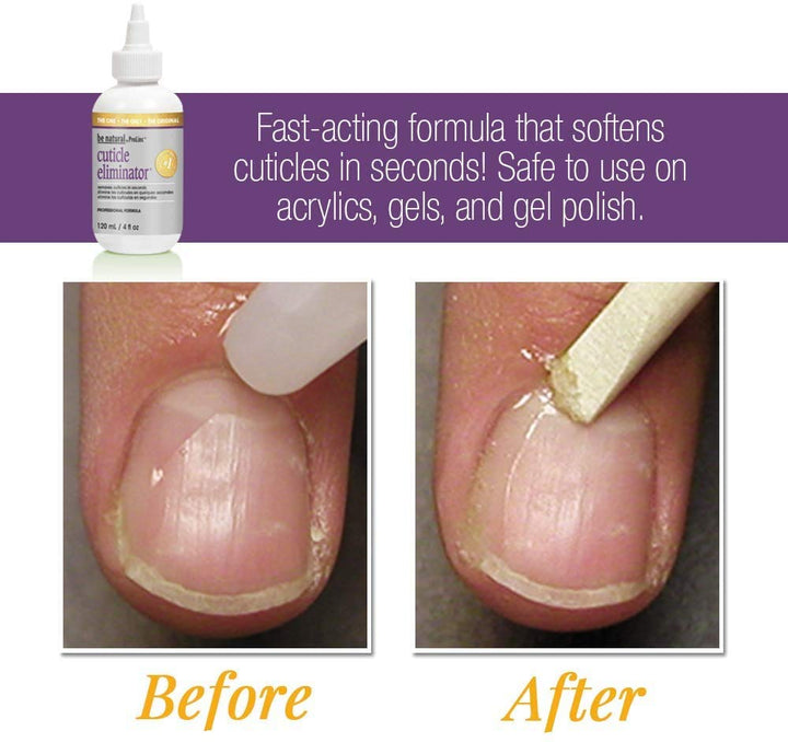 ProLinc Cuticle Eliminator, Softens and Removes Cuticle