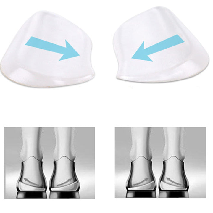 Medial &amp; Lateral Heel Wedge Silicone 2 Pairs - Universal - Adhesive Shoe Insert for Knock Knee Pain, Bow Legs, Foot Alignment - Pronation, Supination
