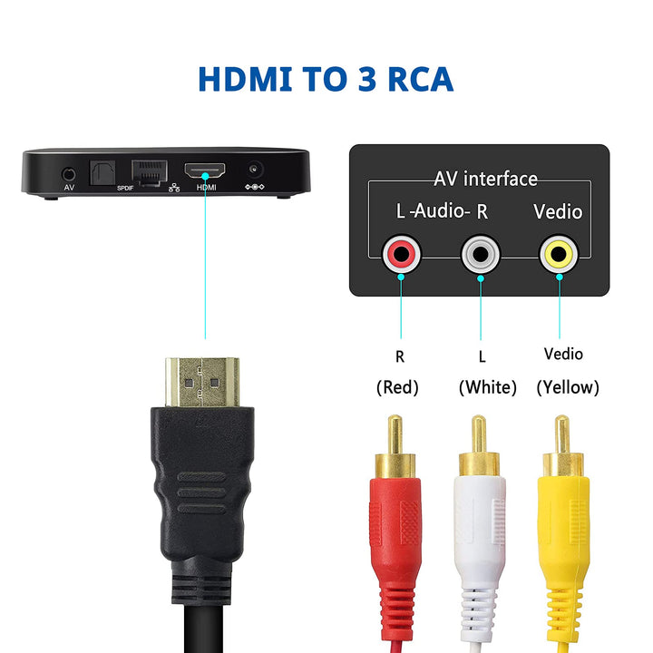 Marmoin HDMI to RCA Cable, 1080P 5ft HDMI Male to 3-RCA