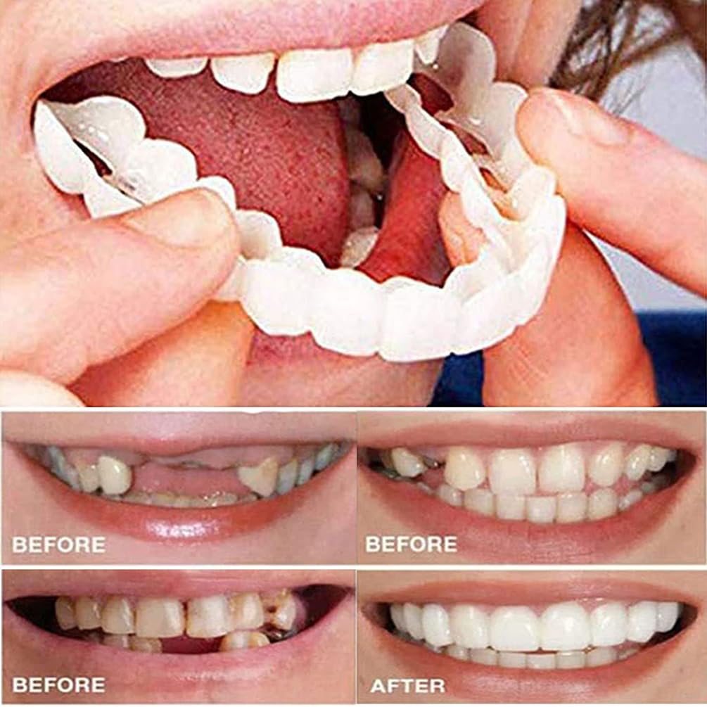 Instant Snap Veneers Dentrues Teeth Socket Perfect Brac