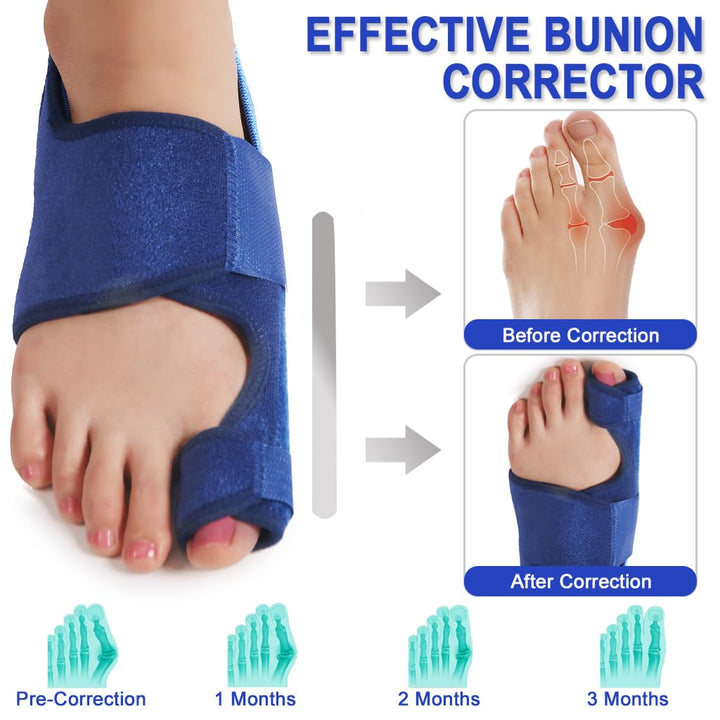 Toe Corrector Toe Separator Bunion Splint 2024 Updated 