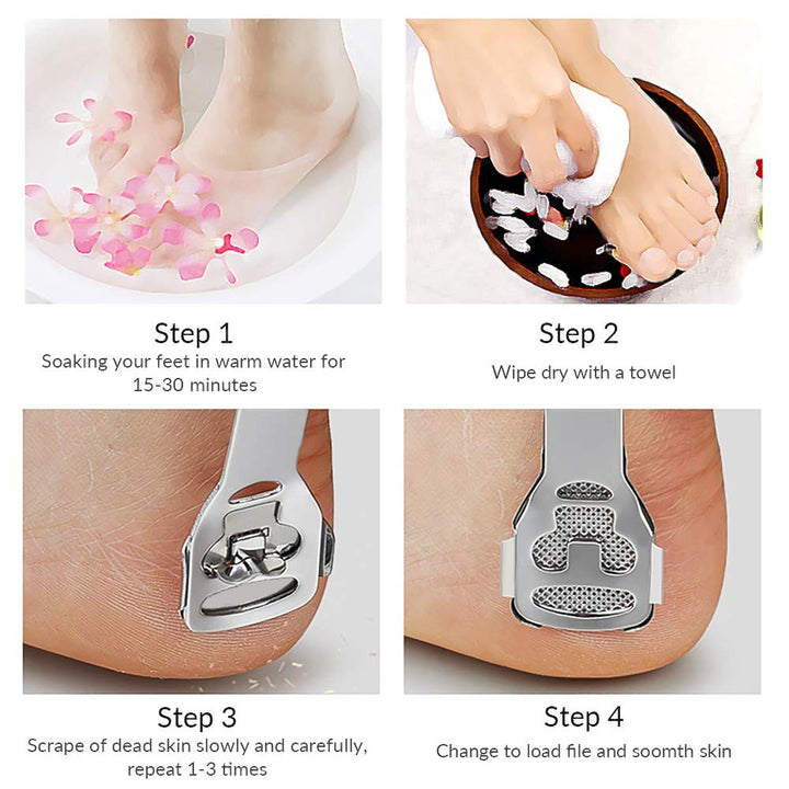 Codream Pedicure Callus Shaver Foot File Care Hard Skin