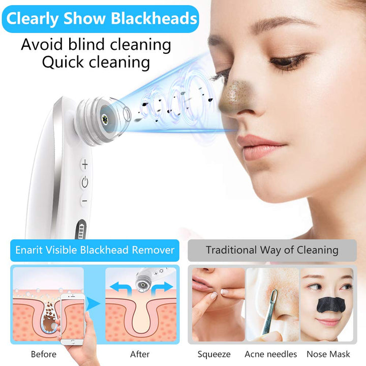 Blackhead Remover Vacuum, Visible Blackhead Remover With 5.0MP Camera -20x Microscope, Upgraded Pore Vacuum Cleaner