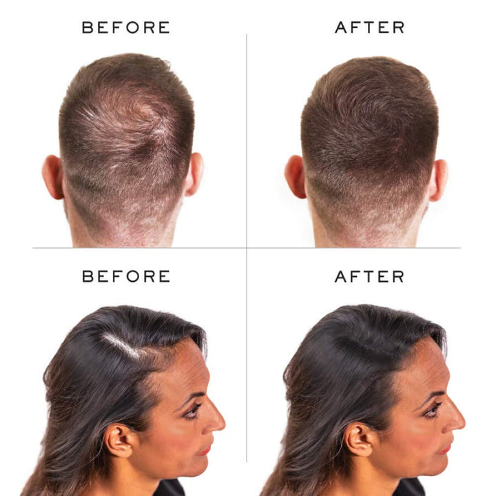 Hair Thickening Keratin Fibres Light Brown