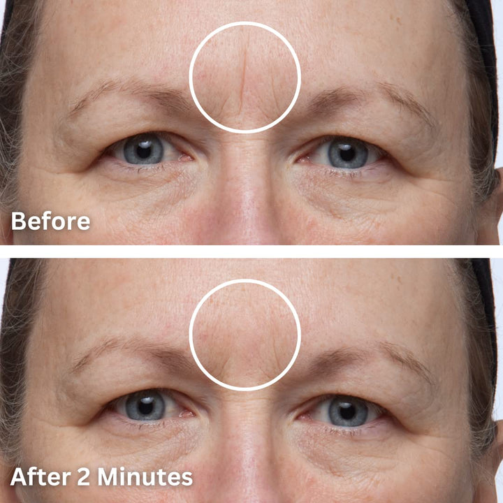 Cover Up - Concealer for Scars, Frown Lines from Hollywood Pro