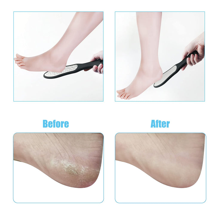 Foot File for Dead Skin, Double Sided Foot Rasp Callus Remover for Wet and Dry Feet, Professional Foot Care Pedicure Tool with Stainless Steel File to Remove Hard Skin.