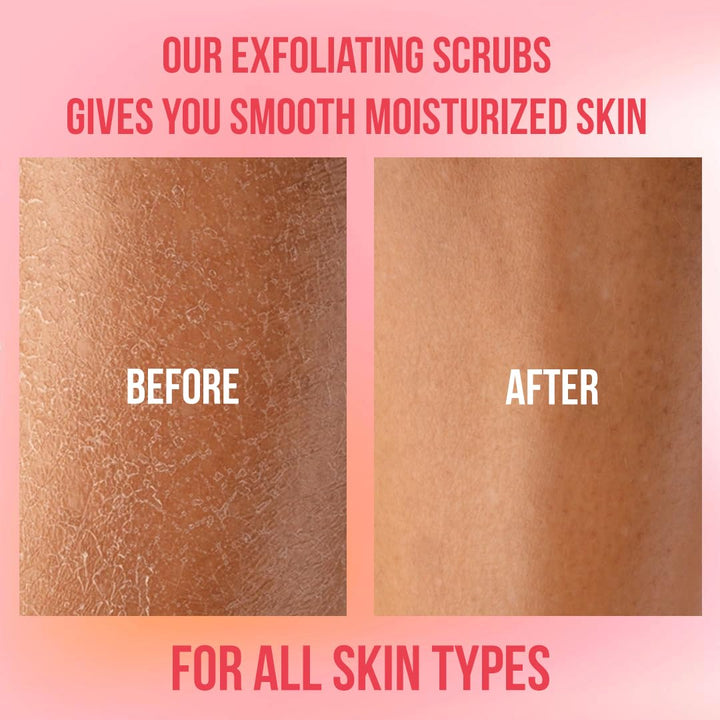 Himalayan Salt Body Scrub, Pink Exfoliator For Women, Exfoliating Scrub for Soft Skincare, Removes Dead Skin Cells, Natural Face Foot Hands Exfoliation Deep Cleansing &amp; Moisturize Skin Large 12oz Jar