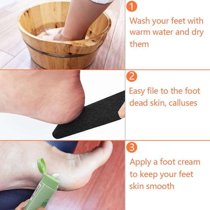Foot Scrubber Callus Remover for Dead Skin,Corn and Hard Skin,Pumice Stone Pedicure Tool Foot File fit Wet and Dry Feet - 1 Piece