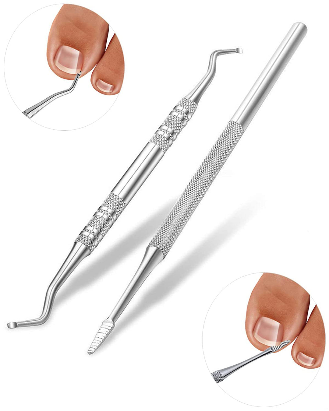 (50 +2) Pack Professional Ingrown Toenail Correction Treatment Kit, 50 Pcs Ingrown Toenail Corrector Straightener Strips Recover Clips with 2 Pcs Ingrown Toenail File And Lifter