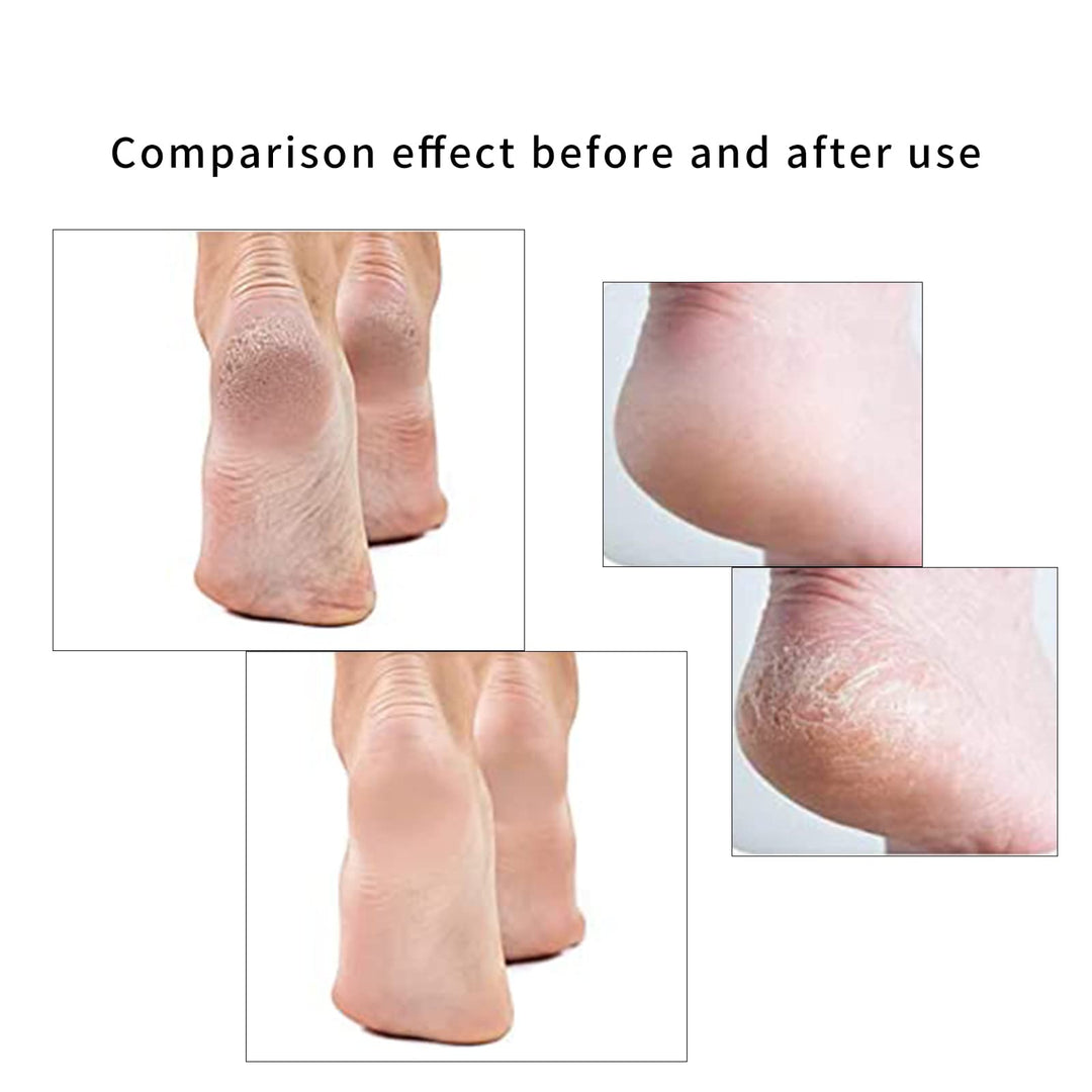Pedicures Replacement Heads, Flawless Pedicures Electri