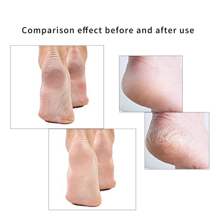 Pedicures Replacement Heads, Flawless Pedicures Electri