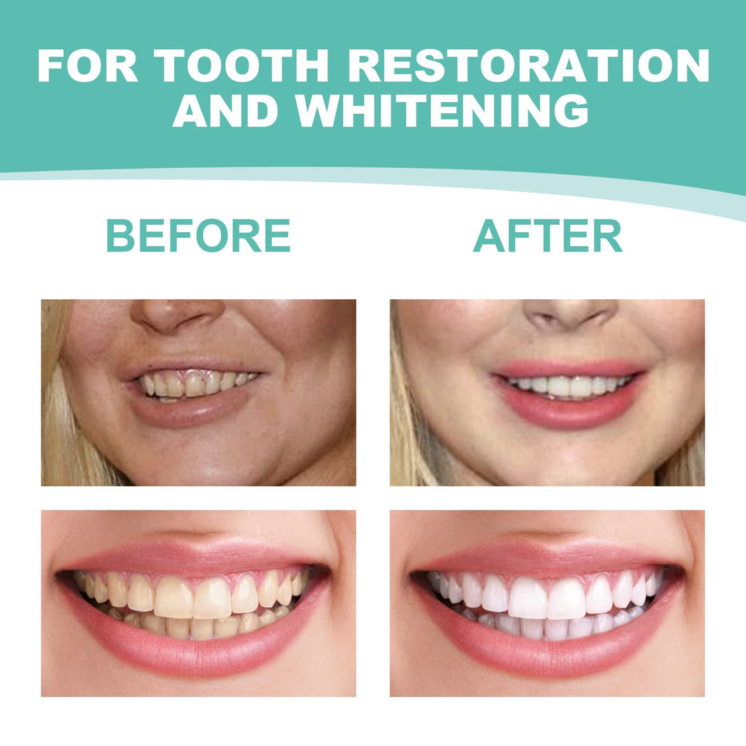Veneers Snap in Teeth Teeth Comfort Fit Whitening Venee