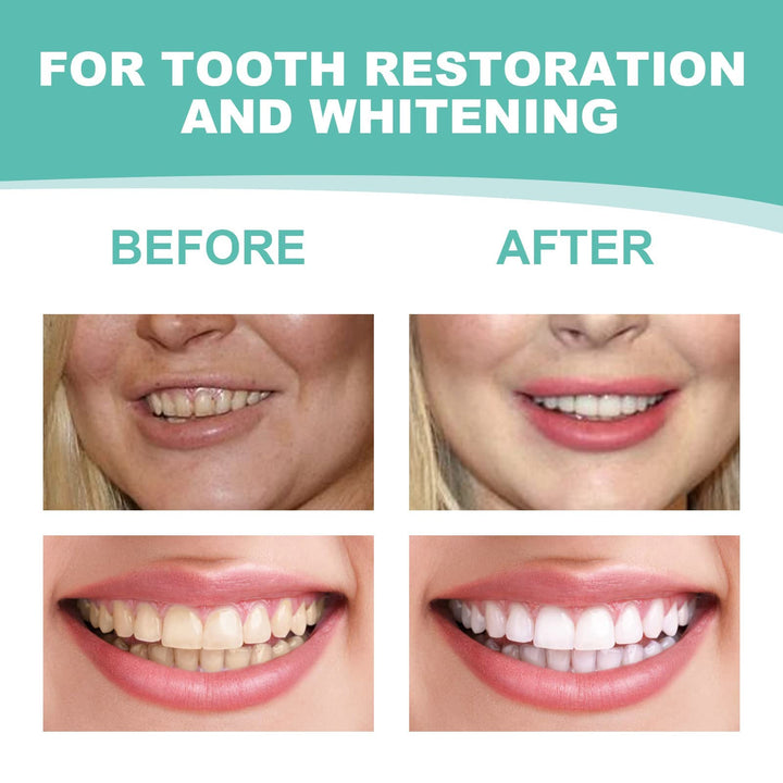 Veneers Snap in Teeth Teeth Comfort Fit Whitening Venee