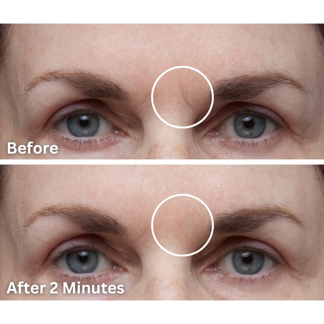 Cover Up - Concealer for Scars, Frown Lines from Hollywood Pro