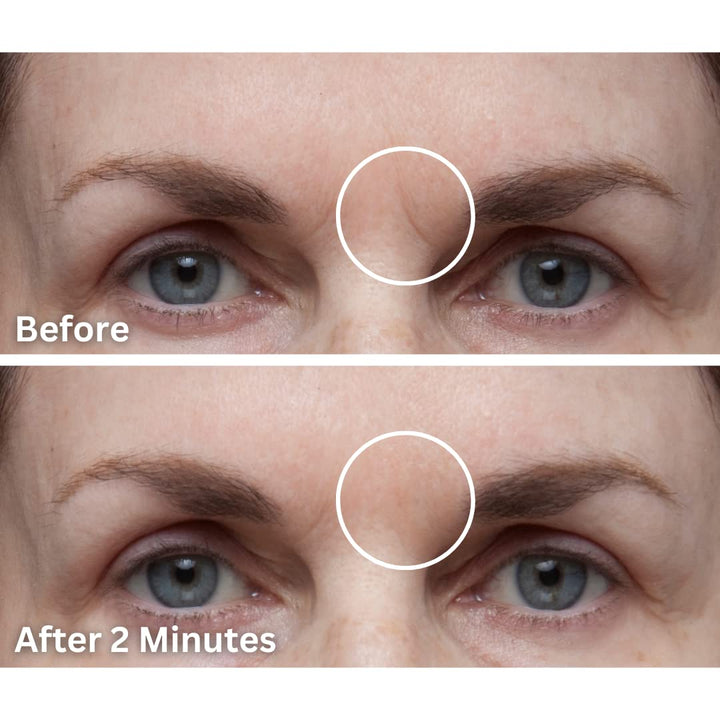 Cover Up - Concealer for Scars, Frown Lines from Hollywood Pro