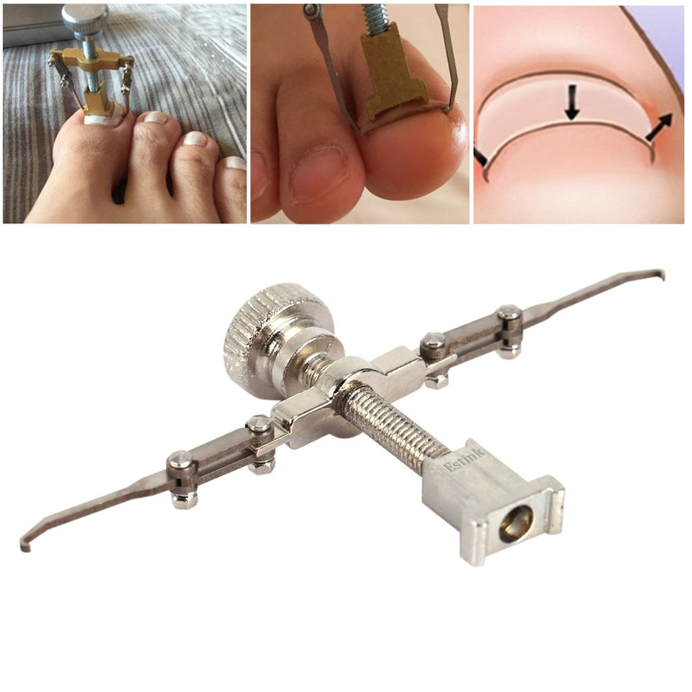 Ingrown Toenail Tool, Carbon Steel Professional Ingrown