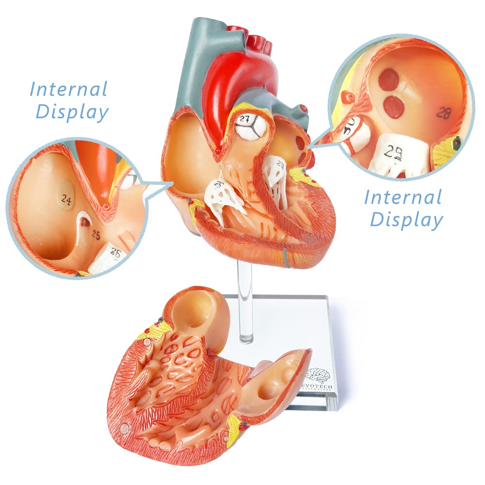 Human Heart Model For Anatomy, 2 - Part Heart Models Anatomy Life Size Medical Heart Model for Classroom and Cardiology Study
