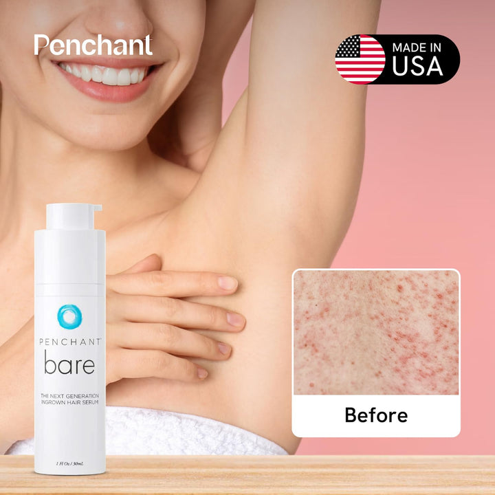 Bare Razor Bump Stopper and Ingrown Hair Treatment for Bikini Area, After Shave Solution for Razor Burns and Bumps, Ingrown Hair Serum for Women and Men 1 Fl Oz