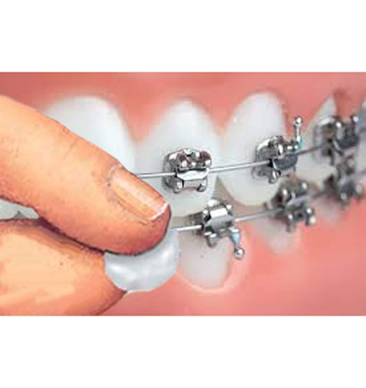Genuine Orthowax - Our Bestseller Orthodontic Wax For B