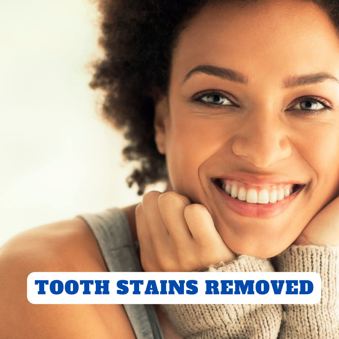 (TM) 44% Carbamide Peroxide Teeth Whitening Gel Refills 44 - Best Teeth Whitening Gels - DIY Tooth Bleaching Gel Syringes - Home Teeth Whitening Refills - Dentist Grade - Professional Strength - Enamel Safe Teeth Whitener - Best