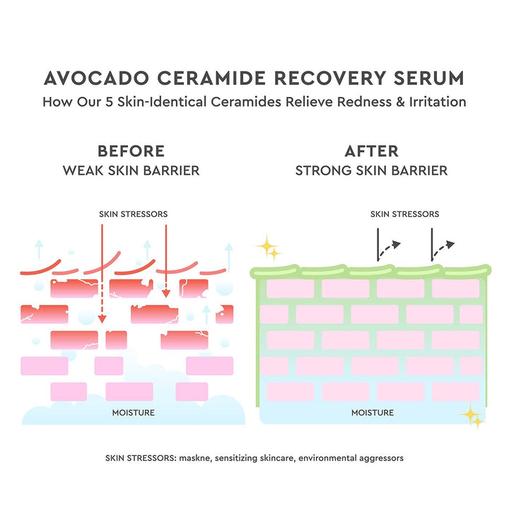 Avocado Ceramide Serum - Hydrating Face Serum for Women &amp; Men - Redness Relief, Dry Skin &amp; Skin Barrier Repair - Lightweight, Milky Texture for Sensitive Skin (30 ml)