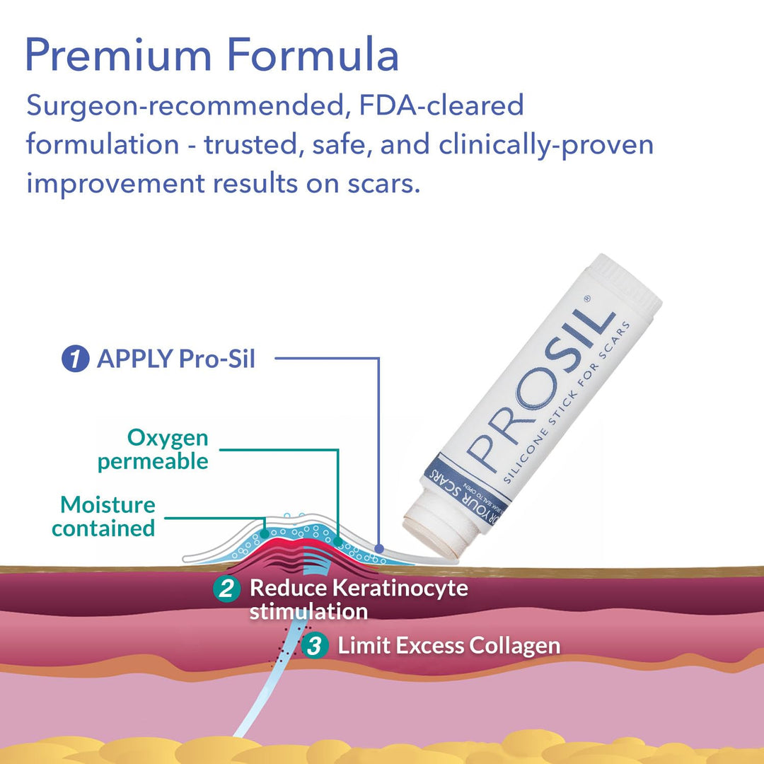 ProSIL Silicone Scar Stick - Scar Gel for Surgical Scars, Acne, &amp; Burns - Silicone Gel for Scars is Safe for Children, Men &amp; Women - Silicone Scar Gel Provides Effective Scar Therapy, 17g