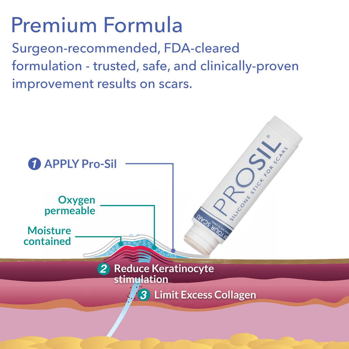 ProSIL Silicone Scar Stick - Scar Gel for Surgical Scars, Acne, &amp; Burns - Silicone Gel for Scars is Safe for Children, Men &amp; Women - Silicone Scar Gel Provides Effective Scar Therapy, 17g