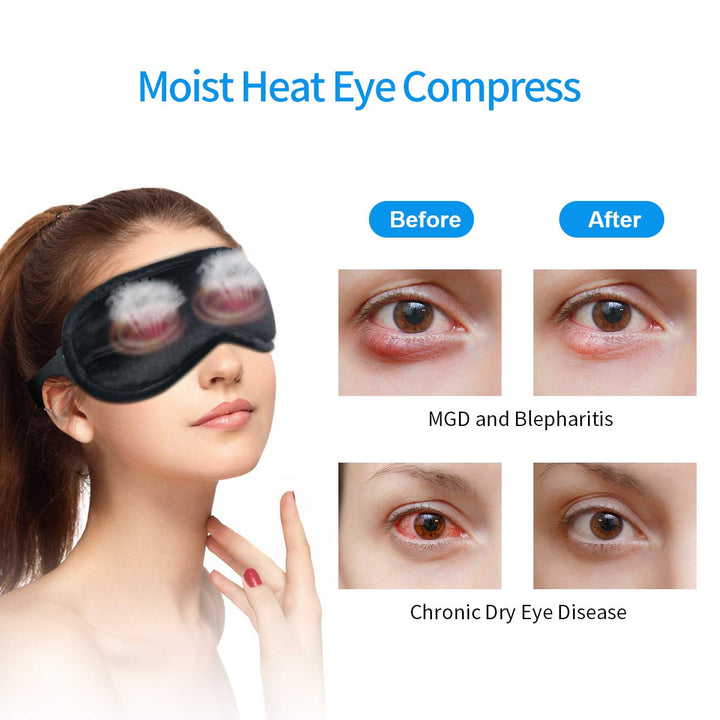 Heated Eye Mask (2-Packs), TOPOINT Moist Warm Eye Compr