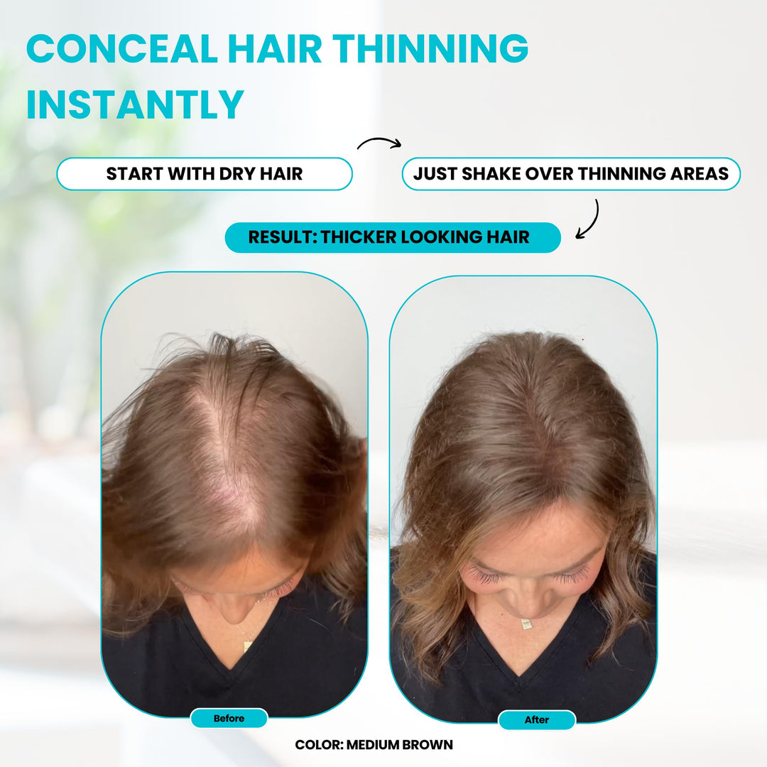 Hair Thickening Fibers - 30g - Natural - High Performance Hair Loss Concealer - Does Not Run When Wet (Medium Brown)