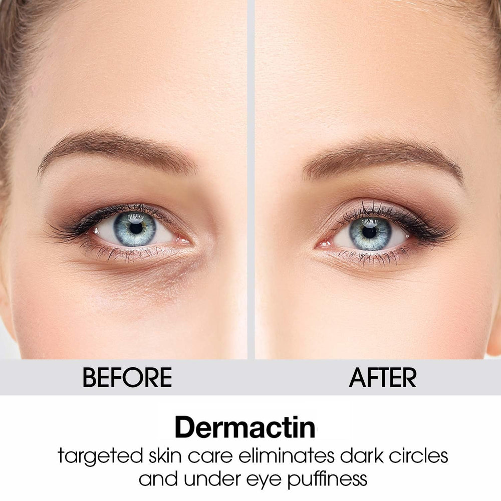 Upper Eyelid Cream 1 oz. Firms & Tones Sagging & Drooping Skin On Upper Eye Lids, for Younger, More Vibrant & Alert Appearance, for Sensitive Skin In The Eyelids