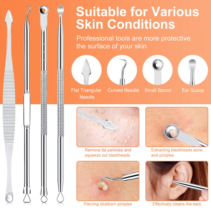 Pimple Popper Tool Kit, 15 PCS Professional Stainless Steel Blackhead Remover Comedone Extractor Tools for Removing Zit on Face - Acne Removal Kit with Metal Case (Silver)