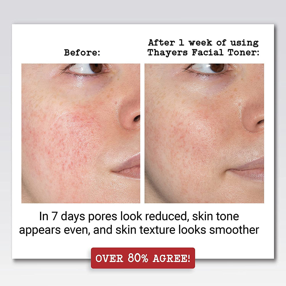 : Witch Hazel with Aloe Vera, Rose Petal Toner 12 oz (2 pack)