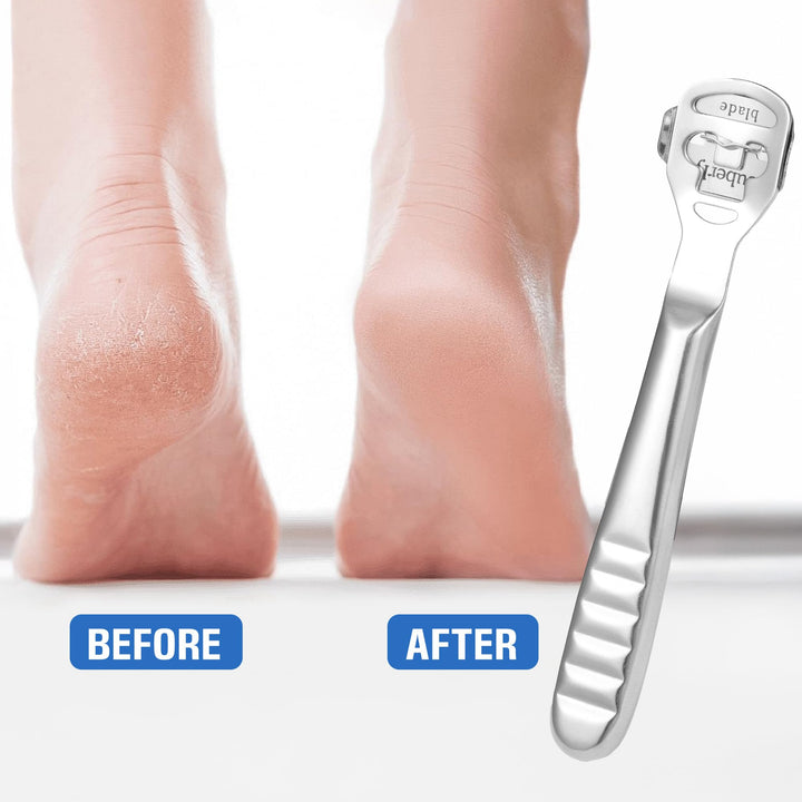 MIUKAA Callus Shaver Kit with 10 Blades, Callus Remover
