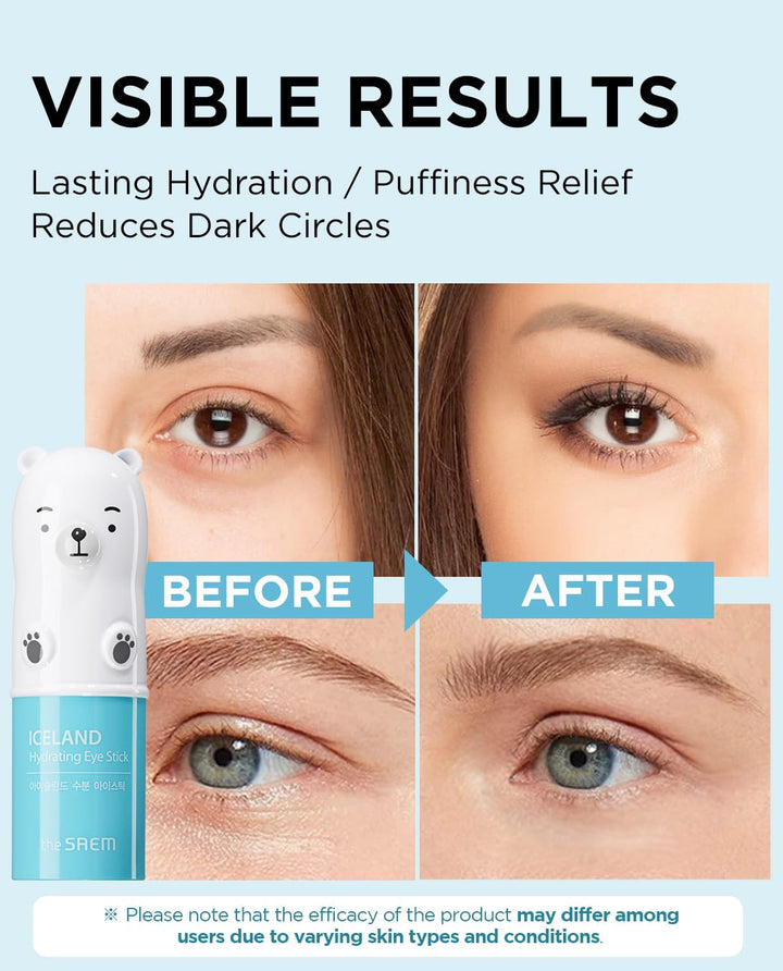 The SAEM Iceland Hydrating Eye Stick 0.24oz - Cooling Eye Balm for Dark Circles and Puffiness – Under Eye Treatment - Reduce Wrinkles and Moisturizing - Minimize Dark &amp; Puffy Eyes - Aqua Scent