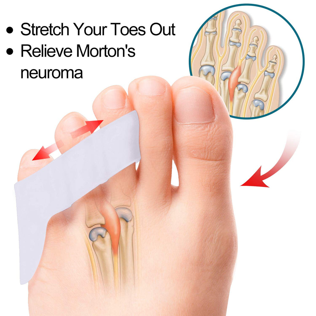 5 Pairs Updated Pinky Toe Straightener: Povihome Pinky 