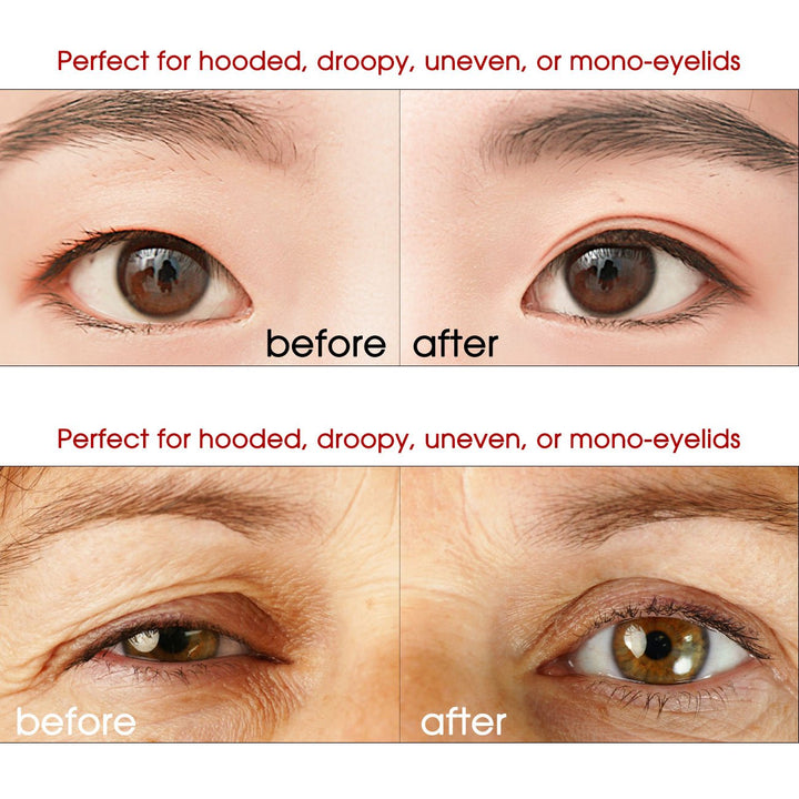 Pormasbenzer Both Sides Sticky Ultra Instant Lift Without Surgery Hooded, Droopy, Uneven, Mono-Eyelids Invisible Fiber Double Side Tapes Stickers (Medium) -240Pcs
