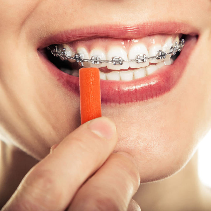 10 Pieces Aligner Chewies for Aligner Chompers Aligner Trays Seater Chewies (Orange)