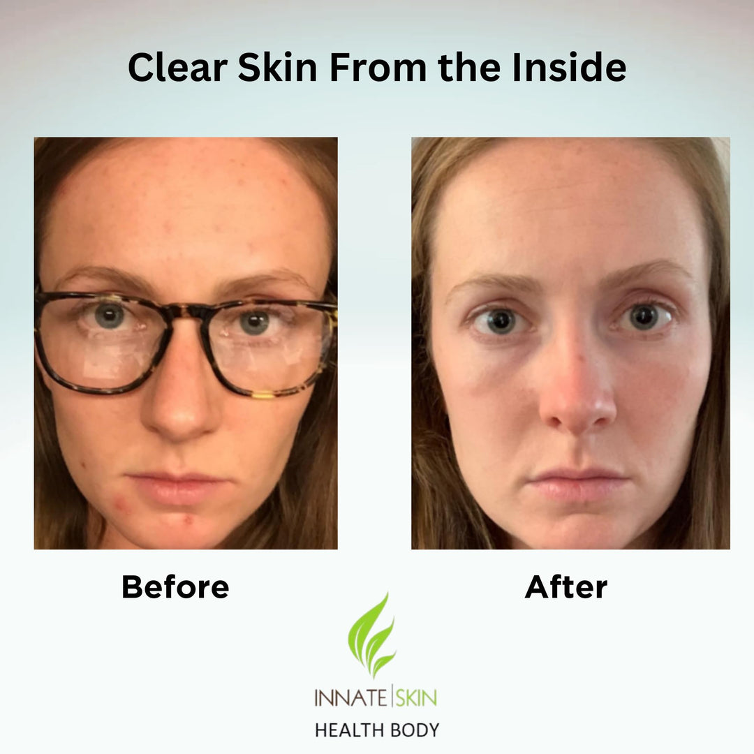 Clear Skin Acne Vitamin System | 20 Antioxidants, Botanicals &amp; Minerals | 60 Count Pack of 2