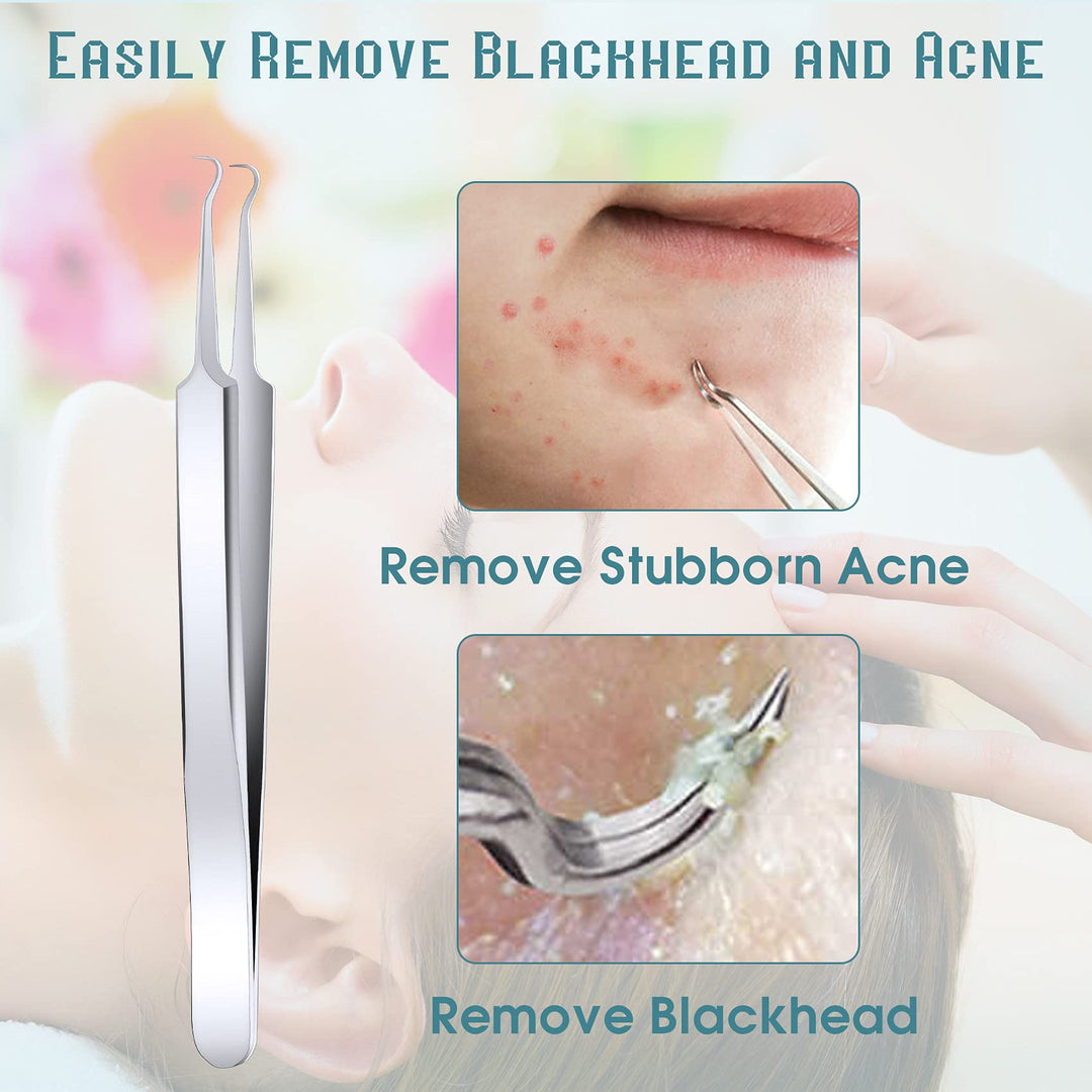 ANCIRS 6 Pack Acne Pimple Blackhead Remover Tweezers, S