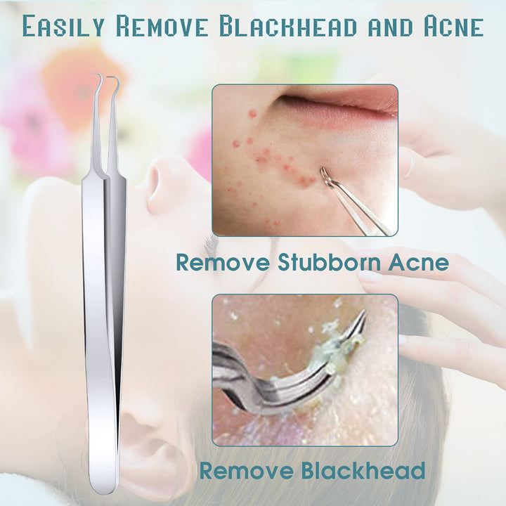 ANCIRS 6 Pack Acne Pimple Blackhead Remover Tweezers, S