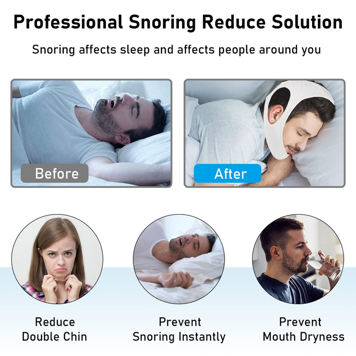 Chin Strap for Cpap Users Anti Snoring Devices - Forzac