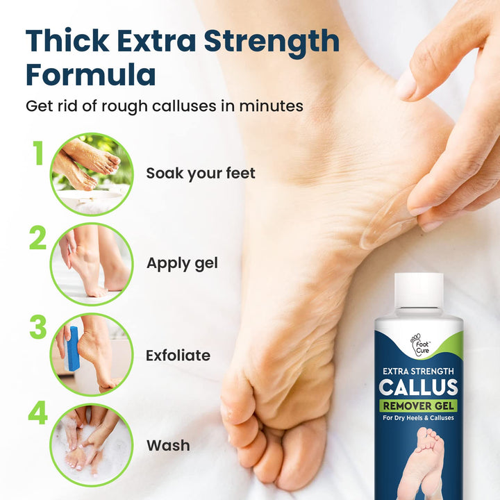 Callus Remover for Feet with Extra Strength Gel &amp; Foot Pumice Stone Set - Easy Way to Remove Hard Calluses &amp; Dead Skin Build-Up - Professional at-Home Foot Care for Men &amp; Women - Made in The USA