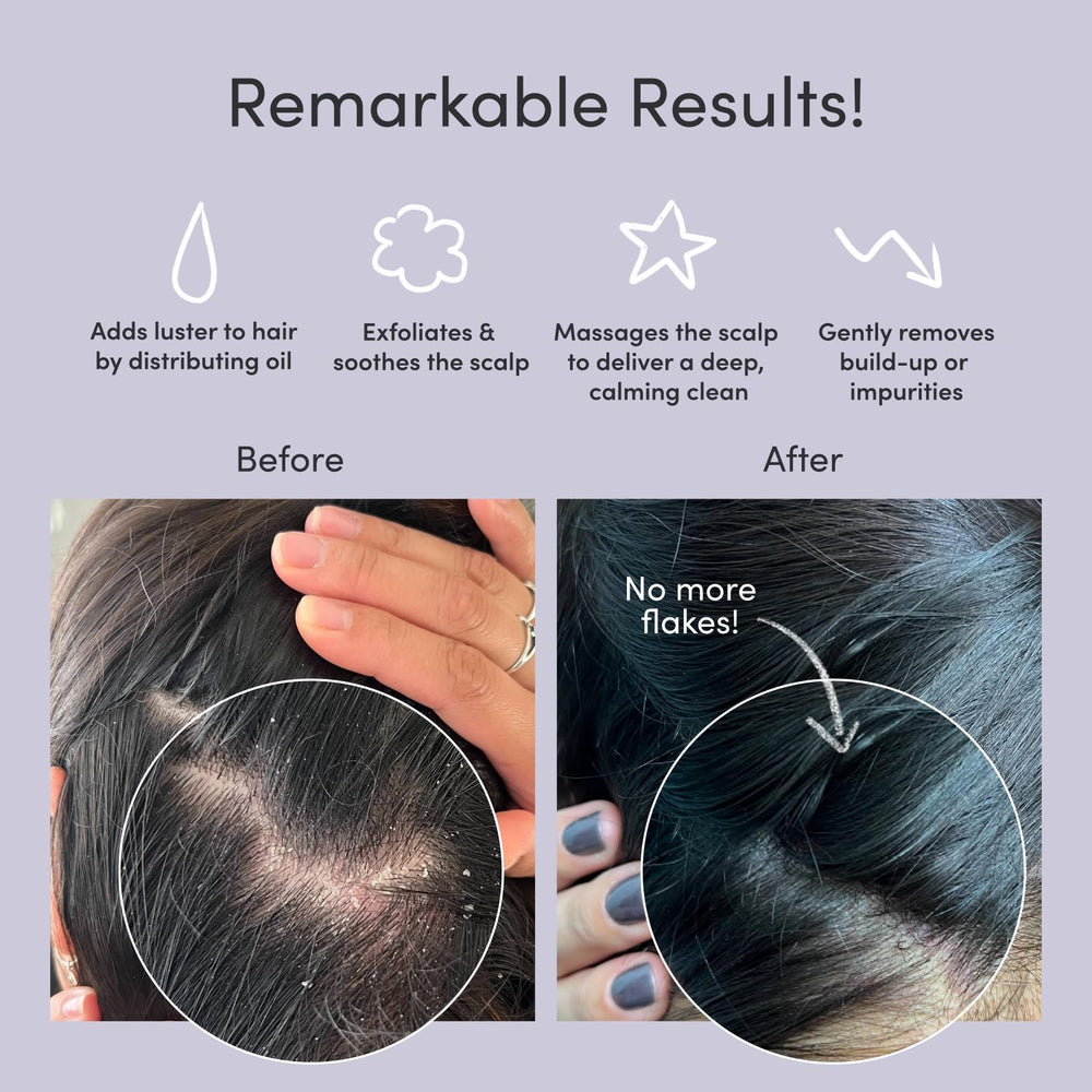 Exfoliator Brush For Removing Dandruff & Build-Up - Detangling Scrubber For Wet or Dry Hair - Supports Circulation & Growth - For All Hair Types - Black