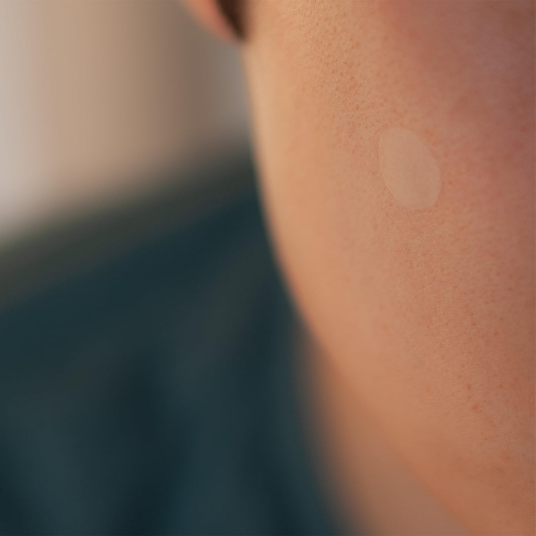 [Perforated] Cover-Dot Acne Care - Clear Acne Absorbing Patch - 24 dots